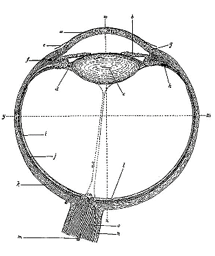 Early day Cataract diagram Early day Cataract diagram