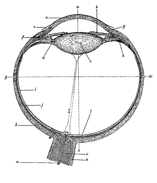 Early day Cataract diagram